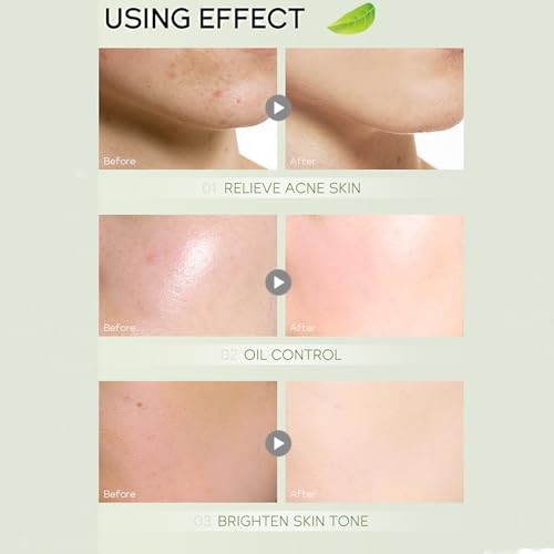 Green Tea Skincare Set, Organic Skin Care Kits Gif... - Image 5